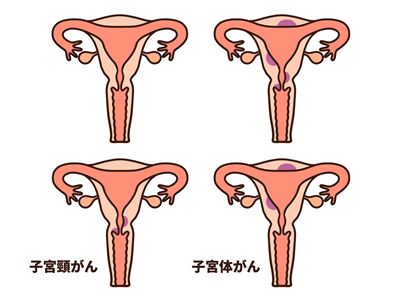子宮体部と子宮頸部