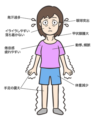 甲状腺の病気の症状